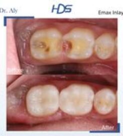 Harub Dental Surgery Shatti Al Qurum